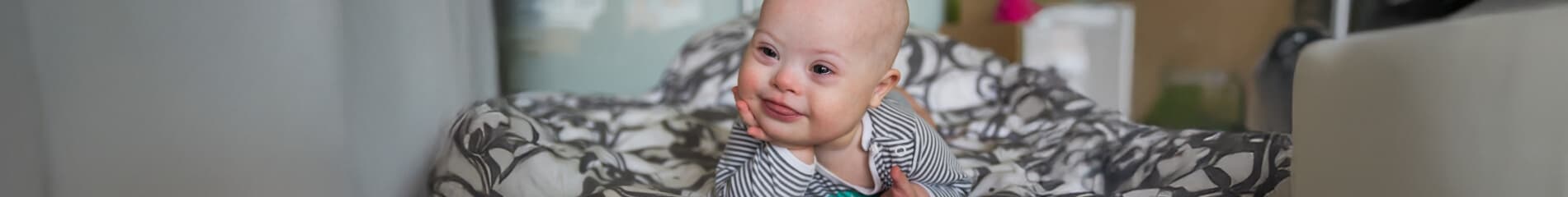 Down’s-Syndrome-Scotland
